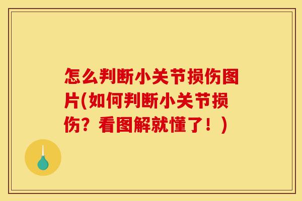 怎么判断小关节损伤图片(如何判断小关节损伤?看图解就懂了!) 怎么判断小关节损伤图片(如何判断小关节损伤?看图解就懂了!)