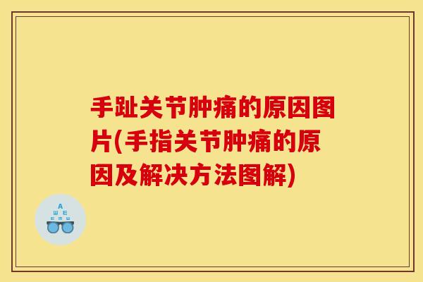 手趾关节肿痛的原因图片(手指关节肿痛的原因及解决方法图解)