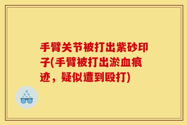 手臂关节被打出紫砂印子(手臂被打出淤血痕迹，疑似遭到殴打)