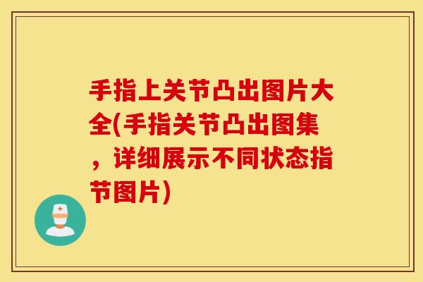 手指上关节凸出图片大全(手指关节凸出图集，详细展示不同状态指节图片)