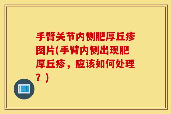 手臂关节内侧肥厚丘疹图片(手臂内侧出现肥厚丘疹，应该如何处理？)