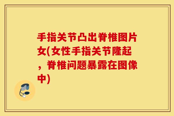 手指关节凸出脊椎图片女(女性手指关节隆起，脊椎问题暴露在图像中)