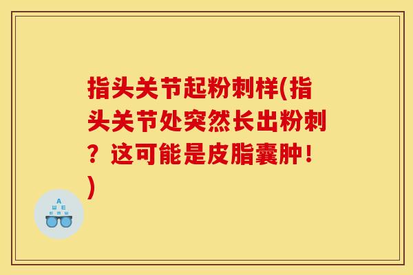 指头关节起粉刺样(指头关节处突然长出粉刺?这可能是皮脂囊肿!) 指头关节起粉刺样(指头关节处突然长出粉刺?这可能是皮脂囊肿!)
