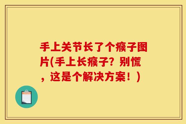 手上关节长了个瘊子图片(手上长瘊子？别慌，这是个解决方案！)