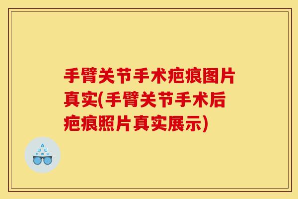 手臂关节手术疤痕图片真实(手臂关节手术后疤痕照片真实展示)