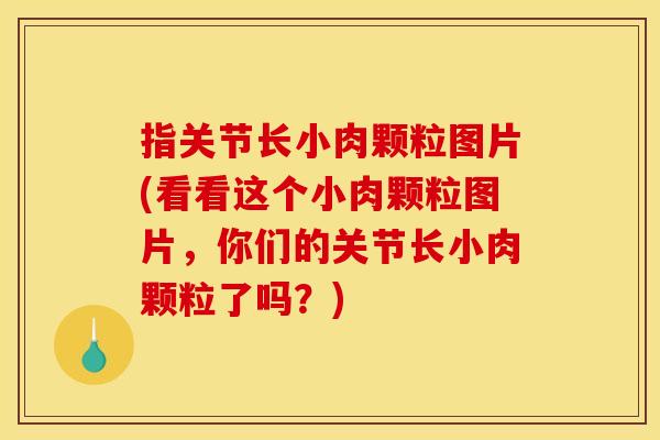 指关节长小肉颗粒图片(看看这个小肉颗粒图片，你们的关节长小肉颗粒了吗？)