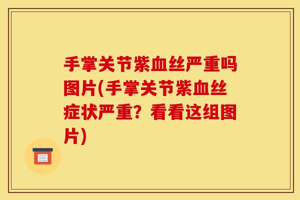 手掌关节紫血丝严重吗图片(手掌关节紫血丝症状严重？看看这组图片)
