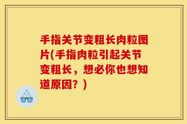 手指关节变粗长肉粒图片(手指肉粒引起关节变粗长，想必你也想知道原因？)