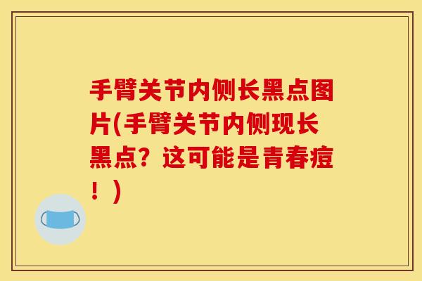 手臂关节内侧长黑点图片(手臂关节内侧现长黑点？这可能是青春痘！)