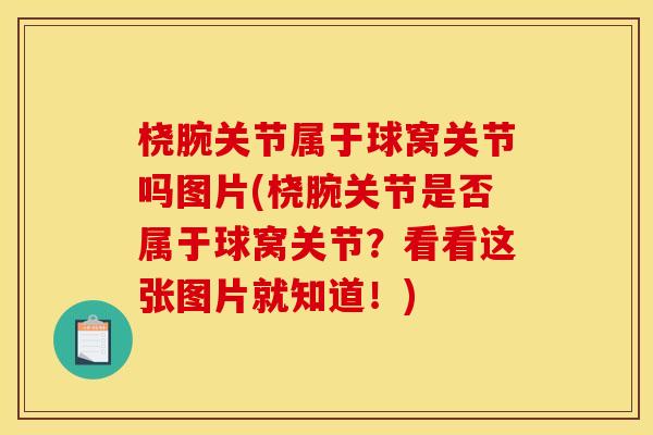 桡腕关节属于球窝关节吗图片(桡腕关节是否属于球窝关节？看看这张图片就知道！)