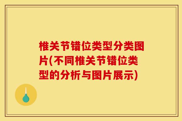 椎关节错位类型分类图片(不同椎关节错位类型的分析与图片展示)