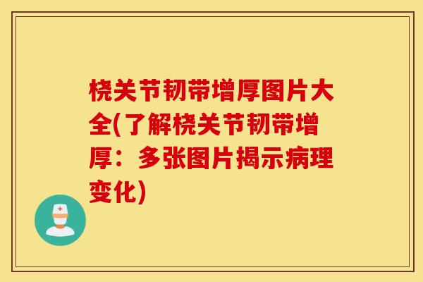 桡关节韧带增厚图片大全(了解桡关节韧带增厚：多张图片揭示病理变化)