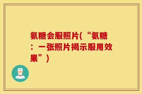 氨糖会服照片(“氨糖：一张照片揭示服用效果”)