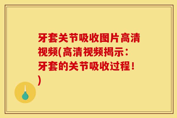 牙套关节吸收图片高清视频(高清视频揭示：牙套的关节吸收过程！)