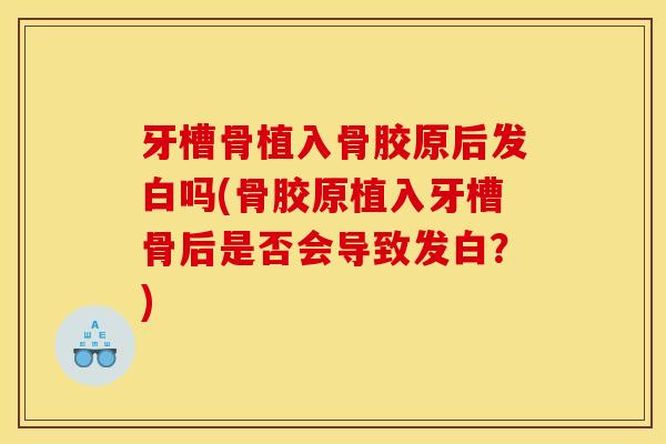 牙槽骨植入骨胶原后发白吗(骨胶原植入牙槽骨后是否会导致发白？)