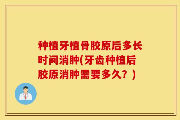种植牙植骨胶原后多长时间消肿(牙齿种植后胶原消肿需要多久?) 种植牙植骨胶原后多长时间消肿(牙齿种植后胶原消肿需要多久?)