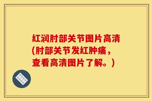 红润肘部关节图片高清(肘部关节发红肿痛,查看高清图片了解。) 红润肘部关节图片高清(肘部关节发红肿痛,查看高清图片了解。)