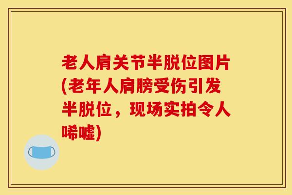 老人肩关节半脱位图片(老年人肩膀受伤引发半脱位，现场实拍令人唏嘘)