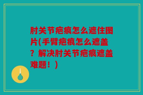 肘关节疤痕怎么遮住图片(手臂疤痕怎么遮盖？解决肘关节疤痕遮盖难题！)