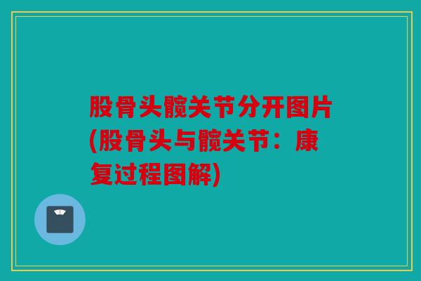 股骨头髋关节分开图片(股骨头与髋关节:康复过程图解) 股骨头髋关节分开图片(股骨头与髋关节:康复过程图解)