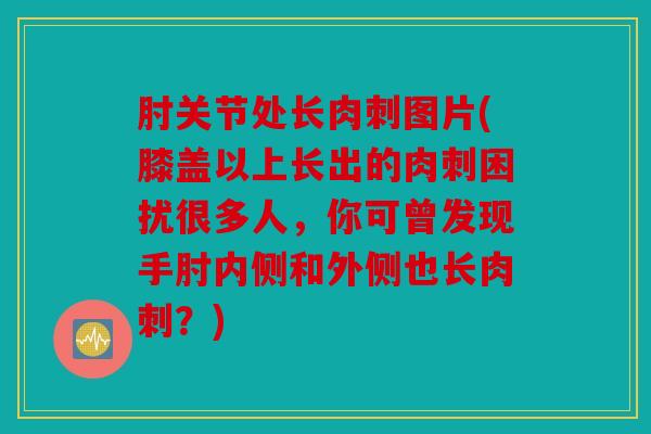肘关节处长肉刺图片(膝盖以上长出的肉刺困扰很多人，你可曾发现手肘内侧和外侧也长肉刺？)