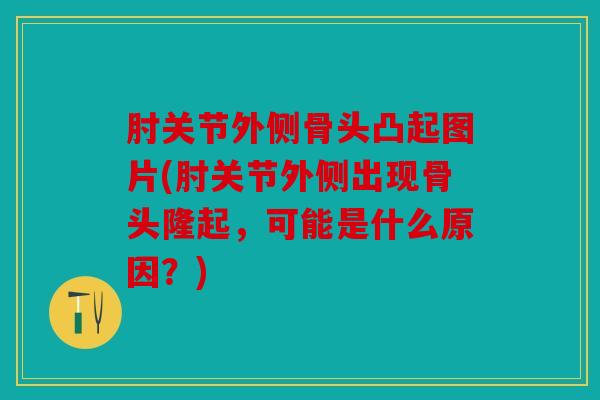 肘关节外侧骨头凸起图片(肘关节外侧出现骨头隆起，可能是什么原因？)