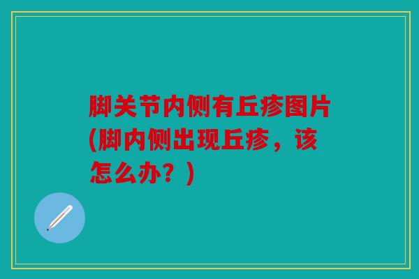 脚关节内侧有丘疹图片(脚内侧出现丘疹，该怎么办？)