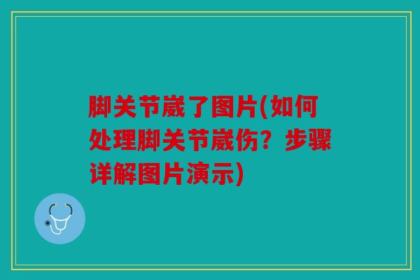脚关节崴了图片(如何处理脚关节崴伤？步骤详解图片演示)