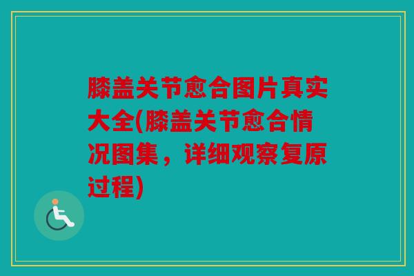 膝盖关节愈合图片真实大全(膝盖关节愈合情况图集,详细观察复原过程) 膝盖关节愈合图片真实大全(膝盖关节愈合情况图集,详细观察复原过程)