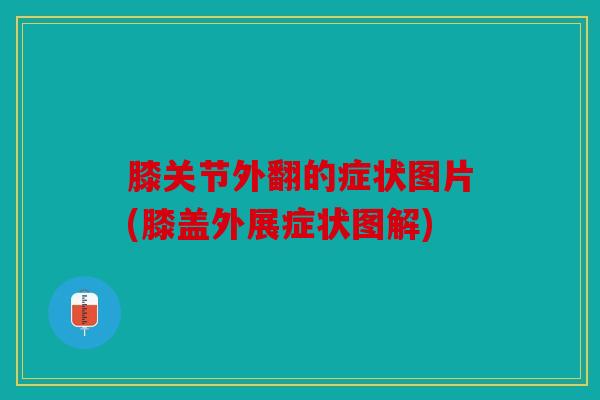 膝关节外翻的症状图片(膝盖外展症状图解)