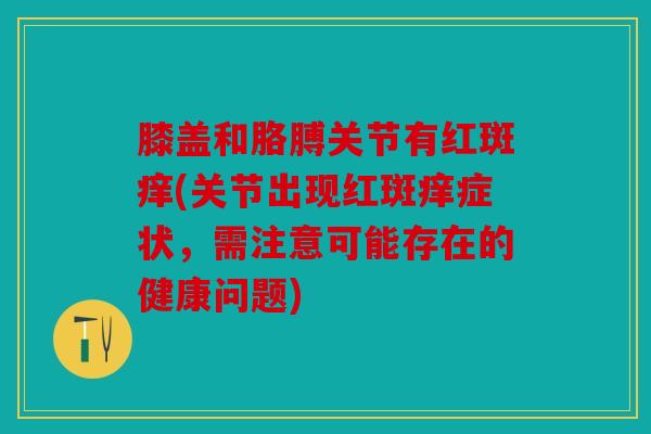 膝盖和胳膊关节有红斑痒(关节出现红斑痒症状，需注意可能存在的健康问题)